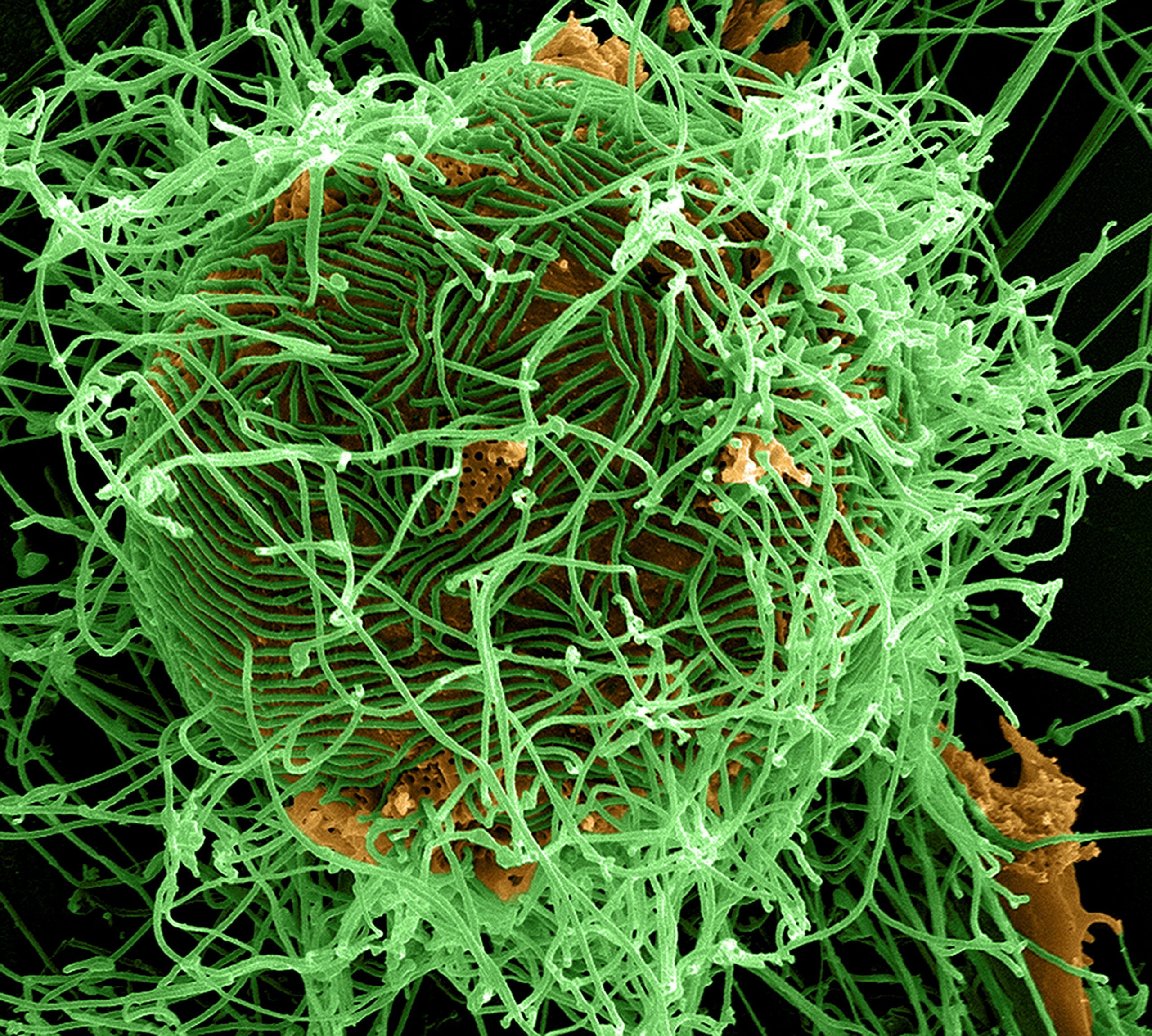 Bundibugyo Ebola Strain: What Filipinos Need to Know